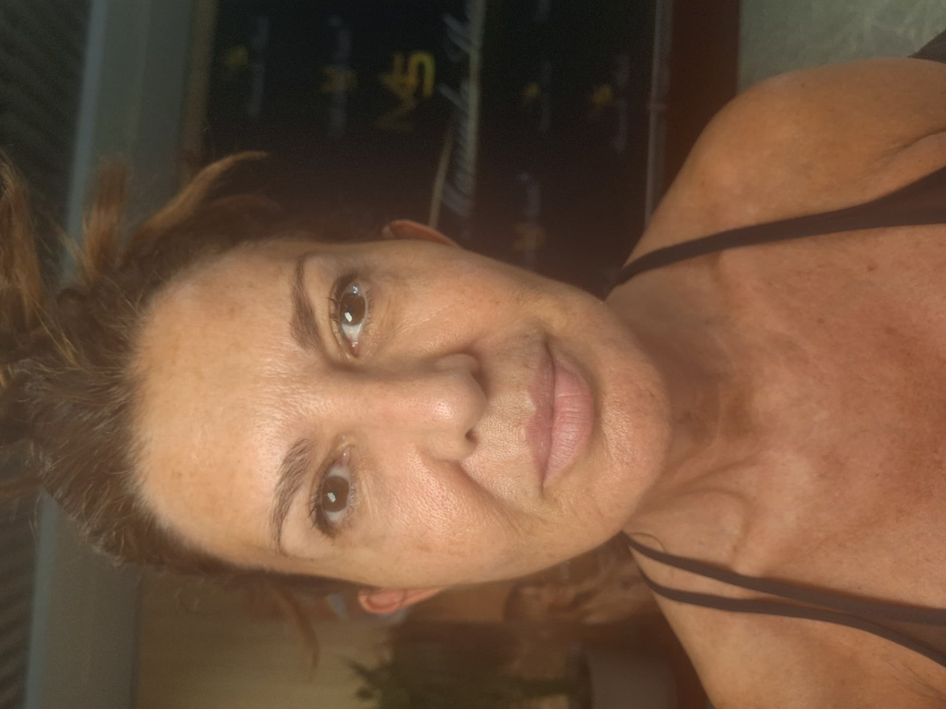 Tratamientos faciales antes