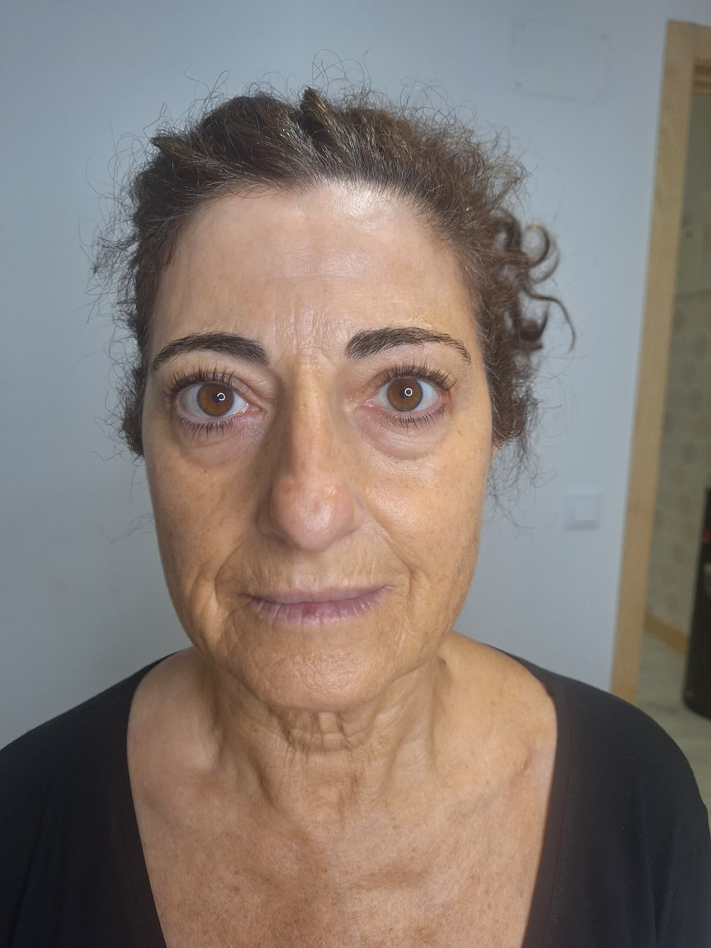 Tratamientos faciales antes